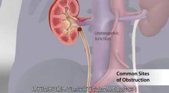 名称：【3D人体详解＋3D演示资料汇总】［原版+字幕版］05描述：3D动画详解人体内部结构、功能，演示各类疾病原理、演变及治疗