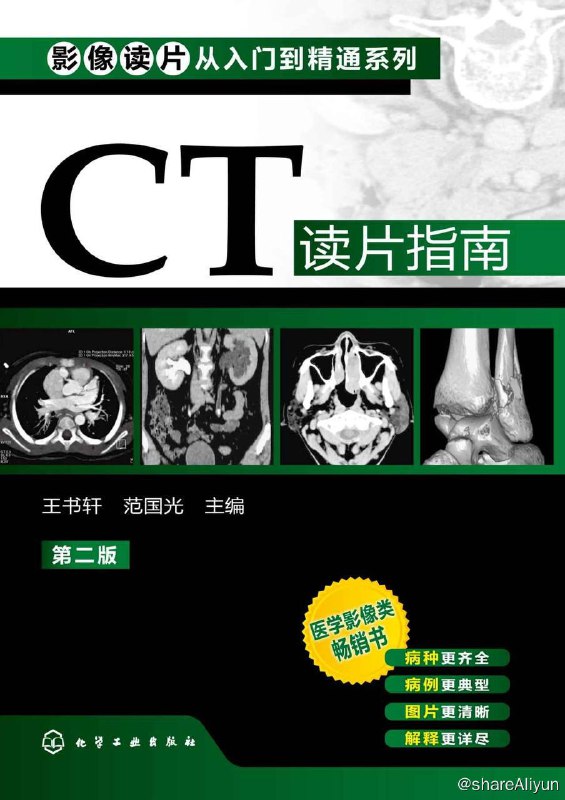 名称：影像读片从入门到精通系列- CT读片指南 (第二版) [EPUB & PDF 电子书]描述：《影像读片从入门到精通系列》第二版（以下简称第二版）仍然按照影像学检查方法的不同分为三个分册，包括《X线读片指南》、《CT读片指南》、《MRI读片指南》
